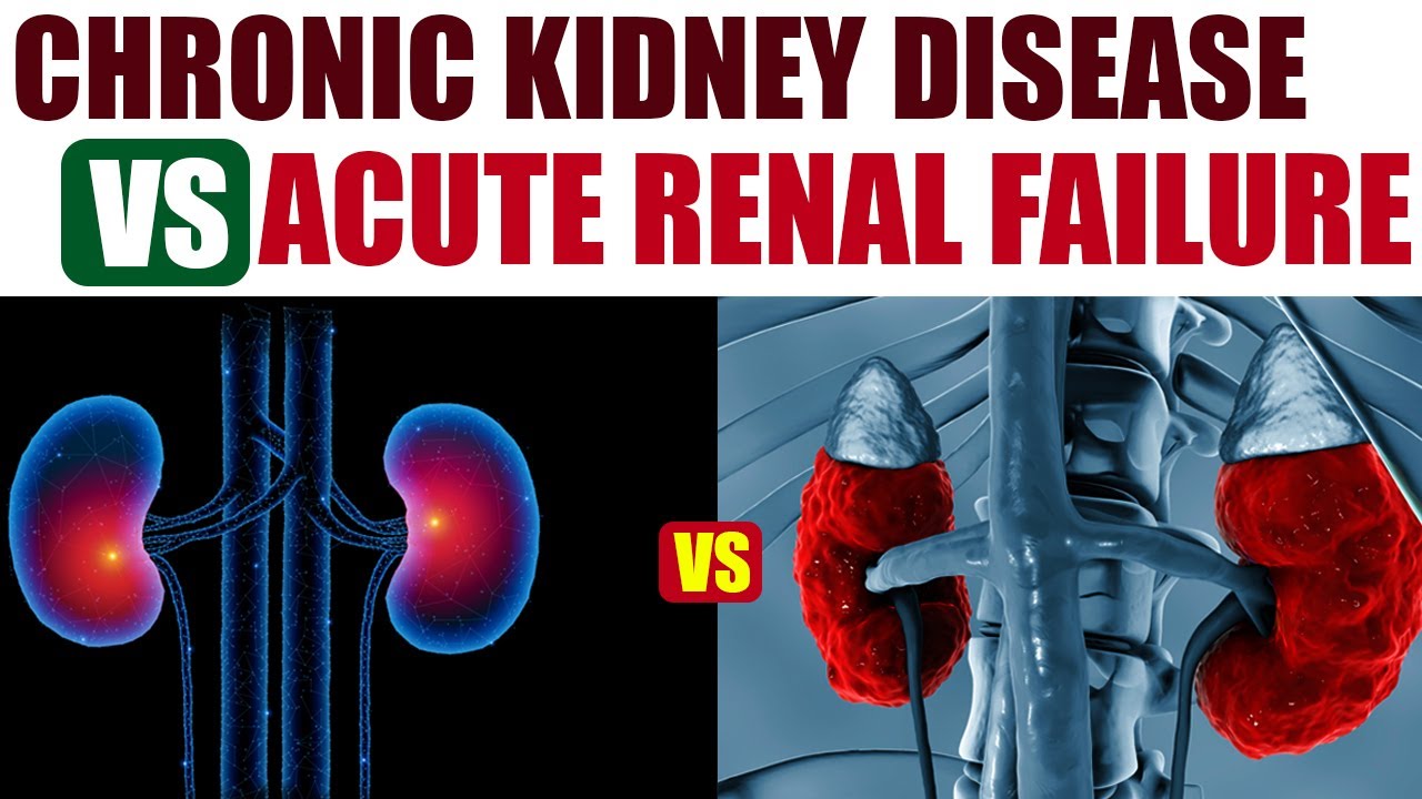 Acute vs. Chronic Renal Failure: Different Approaches to Treatment